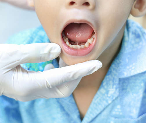 Close up of a child opening their mouth wide