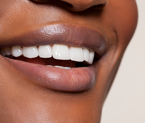 Close up of a person smiling with flawless teeth