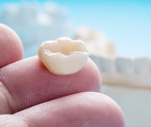 Close up of a dental crown resting on a person's finger